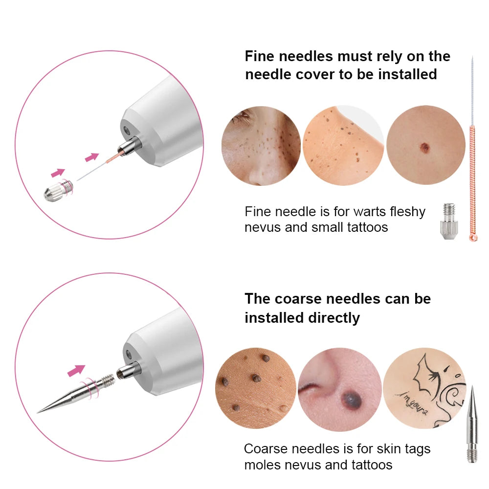 Plasma Pen Mole Warts Removal Dark Spot Black Dot Nevus Freckle Flat Blemish Pimples Remover for Face Body Skin Tag Remover